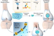 修复成本与费用因素剖析-优乐评测网