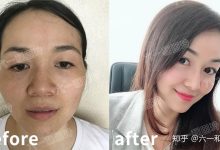 了解一次修护需要多少钱？-优乐评测网