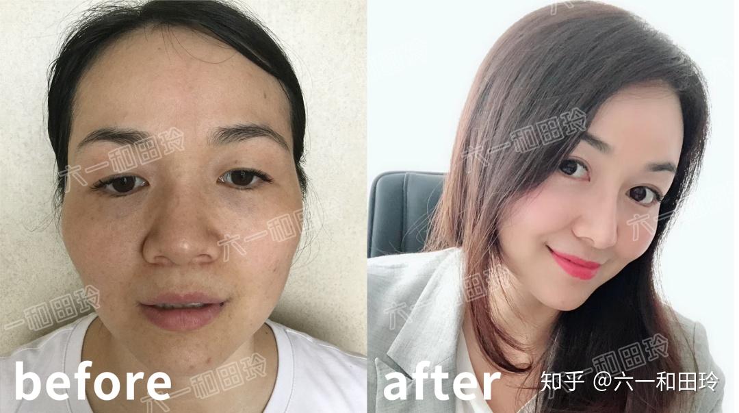 了解一次修护需要多少钱